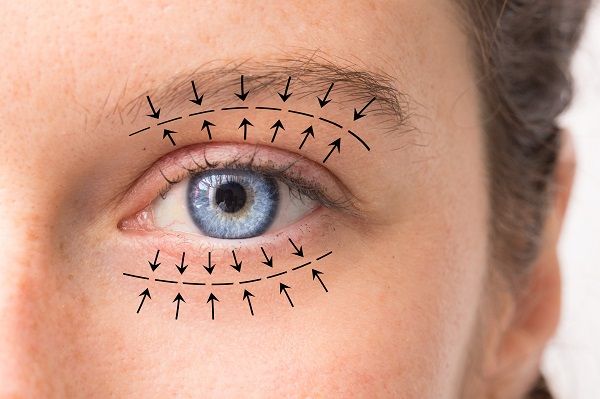 Los mejores cirujanos oculoplásticos de España